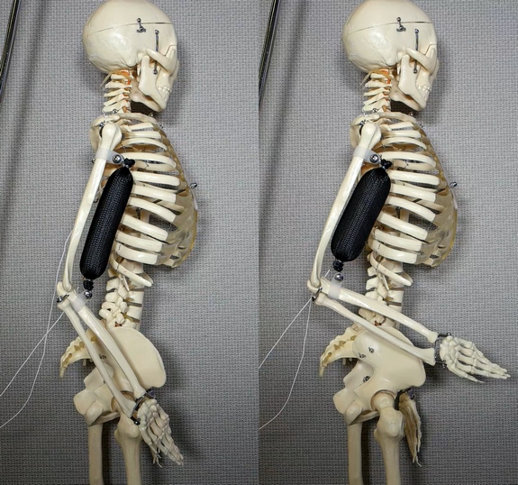 sztuczny mięsień przymocowany do ramienia szkieletu