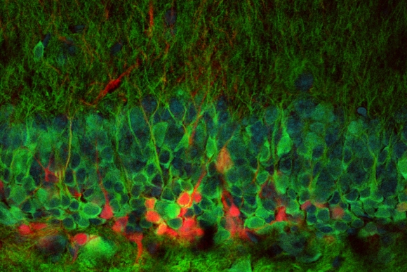 Nowe neurony
