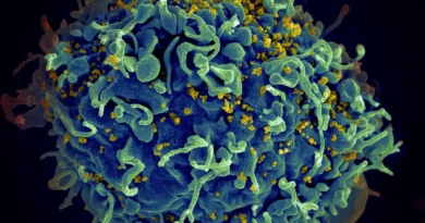 wirus HIV