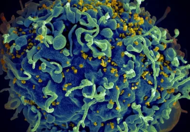 wirus HIV