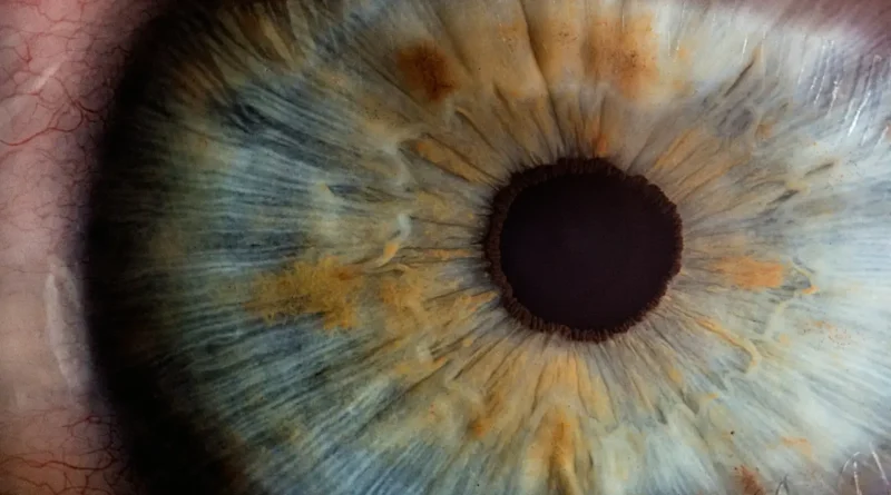 Dziedziczne choroby oczu wcale nie są takie pewne?